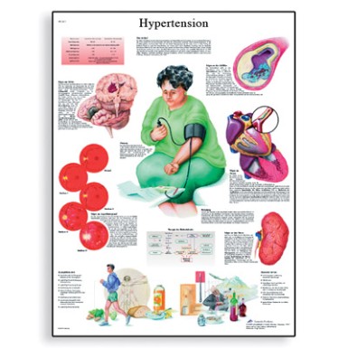 Svjetski dan hipertenzije – „Saznajte koliki je Vaš krvni tlak“